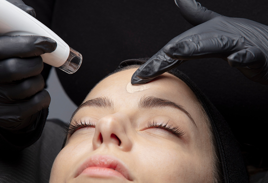 Morpheus8 RF Microneedling Near Florence + Hartsville SC Morpheus8 RF Microneedling Near Florence + Hartsville SC