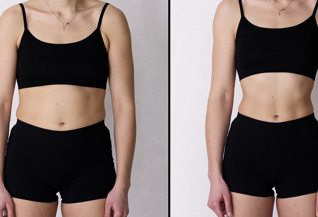 Signature Laser Liposuction Near Florence + Hartsville SC