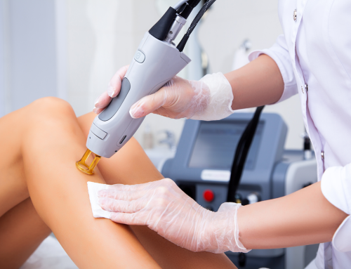 Laser Hair Removal in Florence, SC