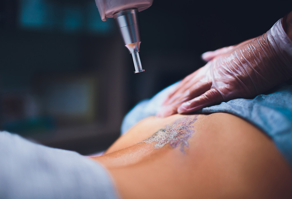 Laser Tattoo Removal Near Florence + Hartsville SC Laser Tattoo Removal Near Florence + Hartsville SC