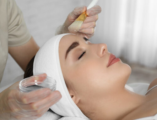 Medical Grade Chemical Peels